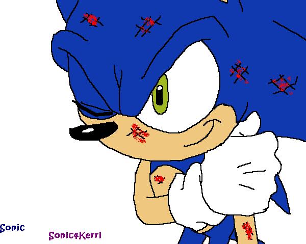 Beaten up Sonic *Request 2 myself* by Sonic4Kerri
